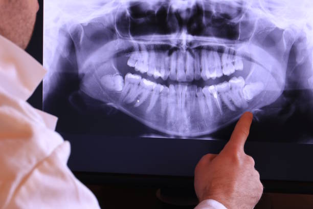 Best Emergency Dental Care for Broken or Chipped Teeth in Marietta, OH