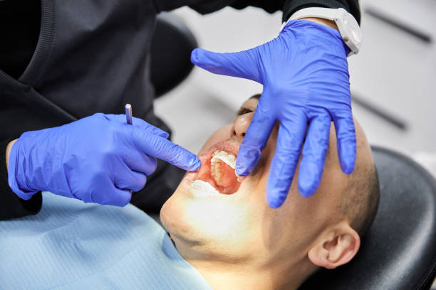Best Emergency Treatment for Dental Infections or Abscesses in Marietta, OH